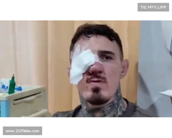 阿斯皮纳尔澄清UFC321退赛原因:视力受损无法继续 阿斯皮纳尔澄清UFC321退赛原因:视力受损无法继续